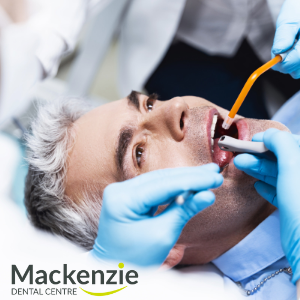 root canal dentist in vaughan