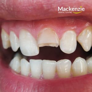 emergency dentist Vaughan