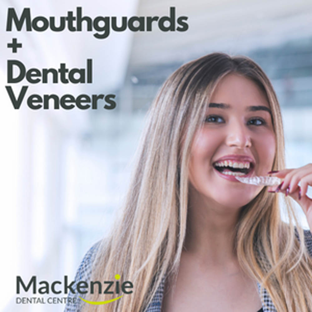 mouthguards and dental veeners