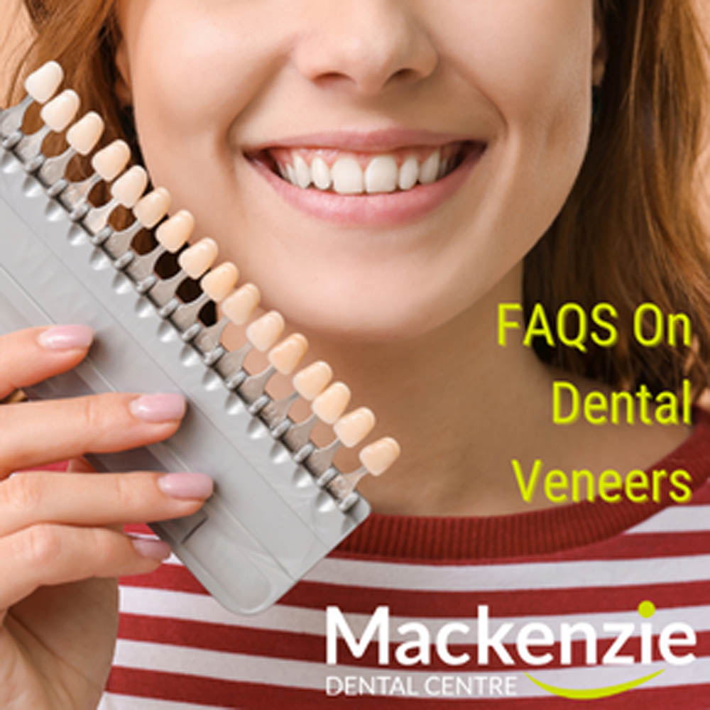 dental veneers woodbridge