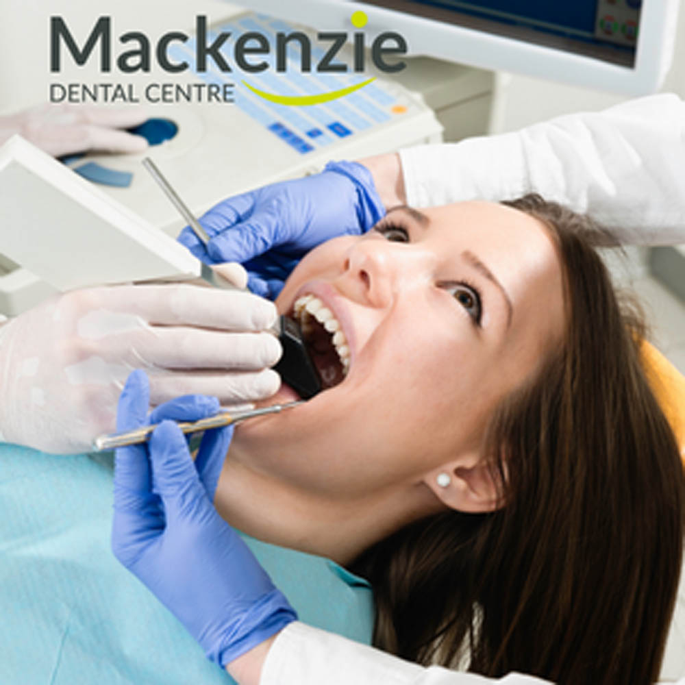 veneers dentist in vaughan