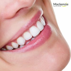 dental implants vaughan