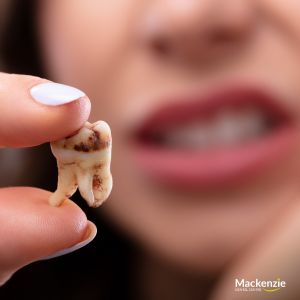 emergency dentist vaughan