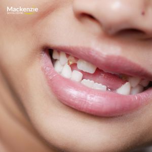 emergency dentist vaughan