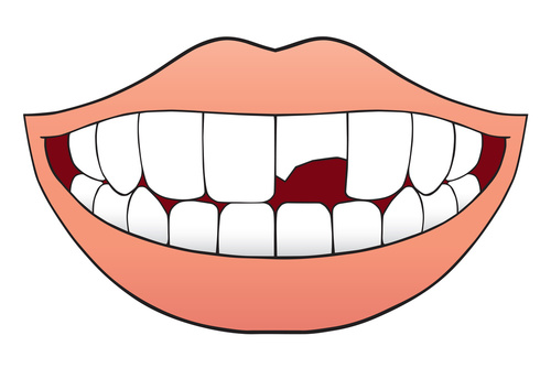 cracked tooth emergency dentist woodbridge