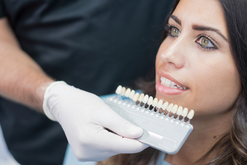 dental veneers patient vaughan