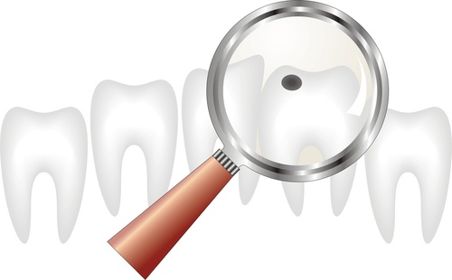 cavity dentist vaughan cavity dentist vaughan