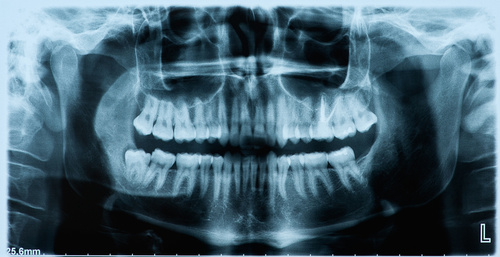 dental x ray imaging dentist healthy vaughan 