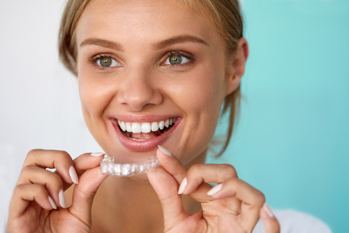 Invisalign clear braces vaughan