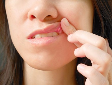 Oral Cancer Symptoms vaughan