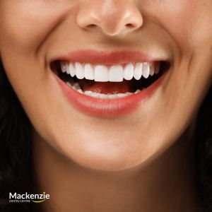 veneers dentist