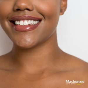 veneers dentist