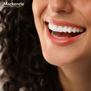 veneers dentist