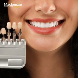 veneers dentist