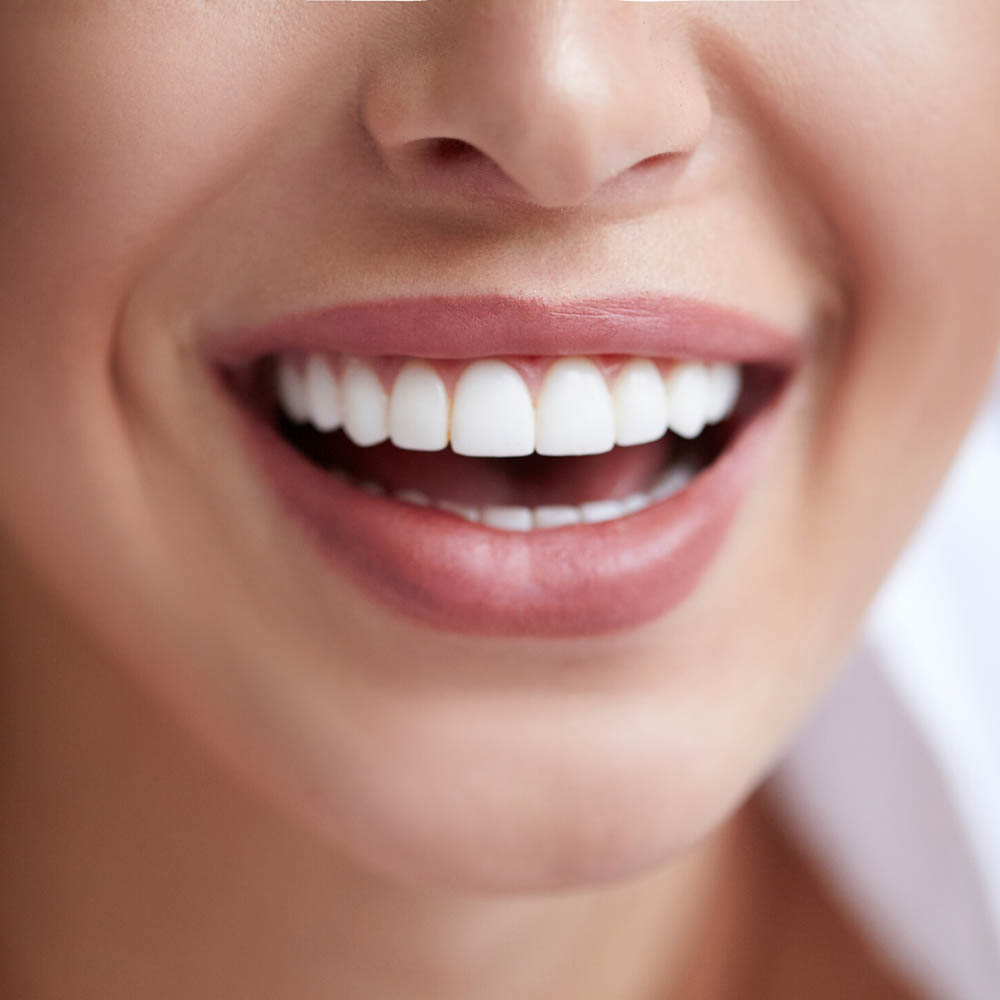 woman smiling with great teeth